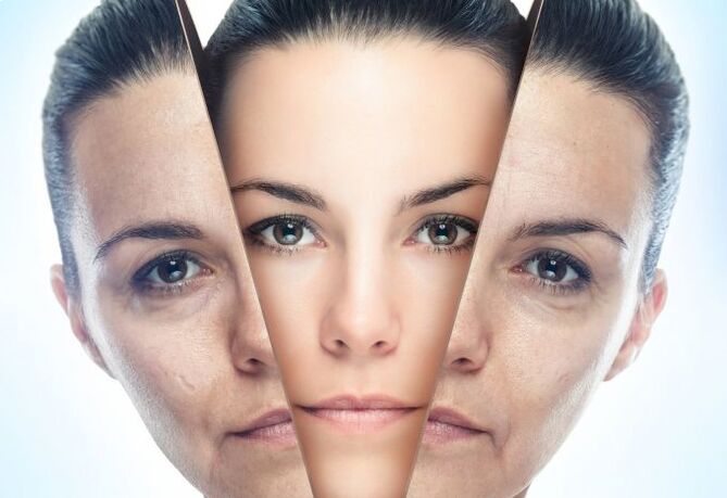 Η διαδικασία εξάλειψης του δέρματος του προσώπου από αλλαγές που σχετίζονται με την ηλικία